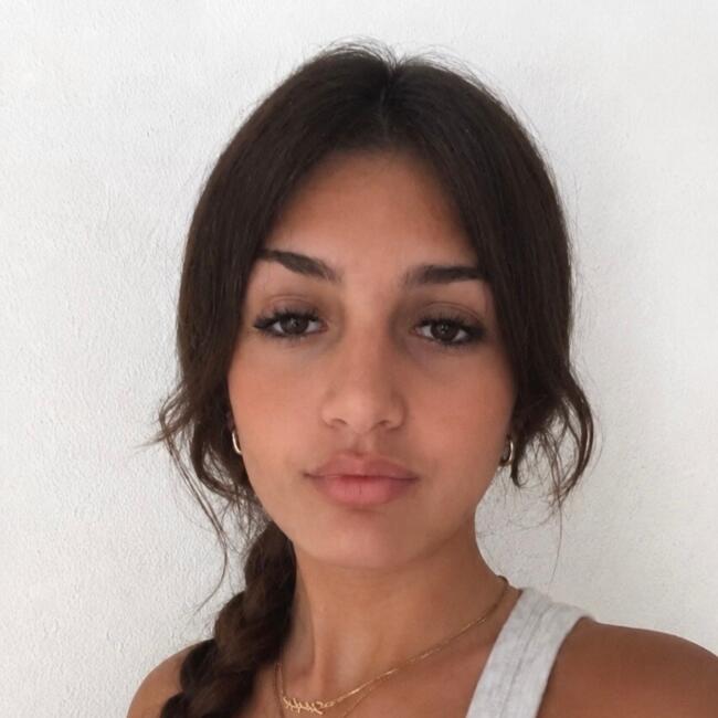Canguro en Güimar: Shayla