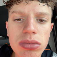 Mathys