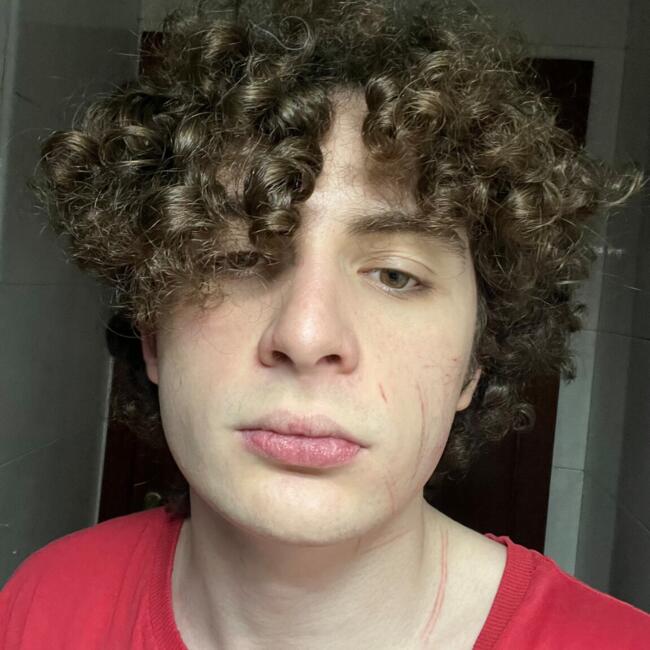 Canguro en Amurrio: Miguel