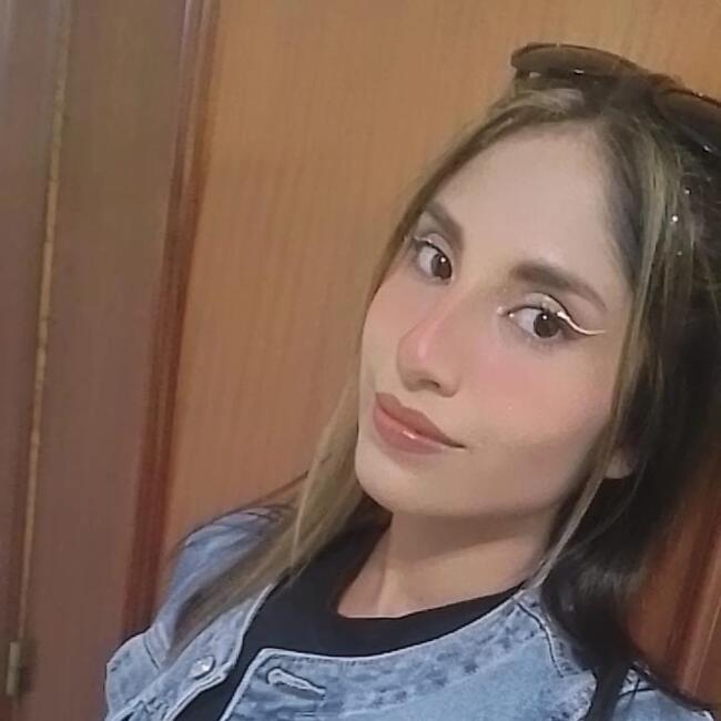 Canguro en San Sebastián de los Reyes: Kimberly