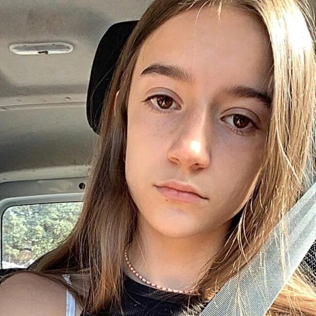 Canguro en El Escorial (Comunidad Autónoma de Madrid): Ana