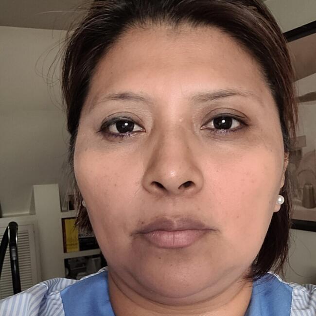Canguro en Madrid: Gloria