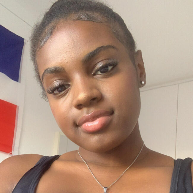 Canguro en Madrid: Estrella