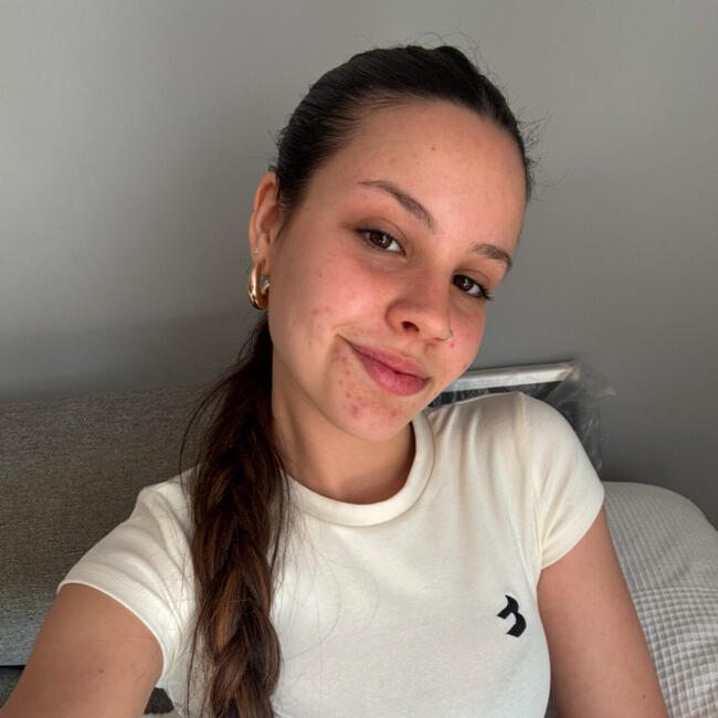 Canguro en San Pedro de Ribas: Duna Moreno