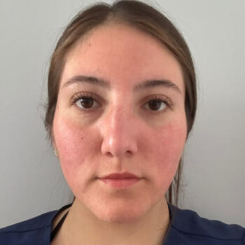 Niñera Viña del Mar: Camila